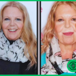 Sally Thomsett Face Illness