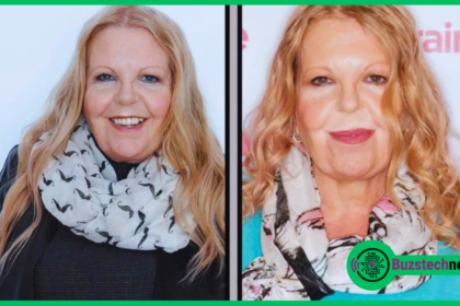 Sally Thomsett Face Illness