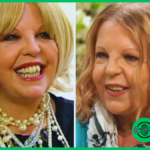 Sally Thomsett Gezichtsziekte