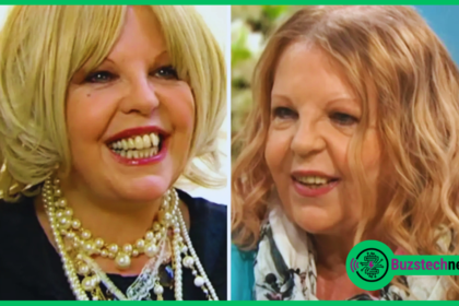 Sally Thomsett Gezichtsziekte